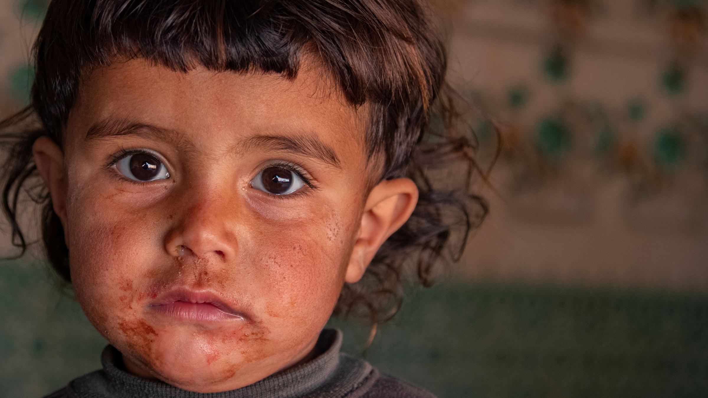 Save the Children