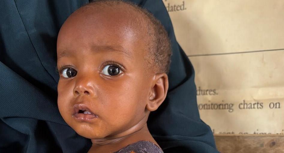 Fardowso, 1 anno, Somalia