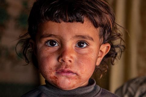 Bambino in una tenda nel nord della Siria - Save the Children