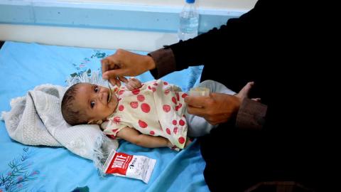  Bambina yemenita malnutrita mangia cibo terapeutico - Save the Children